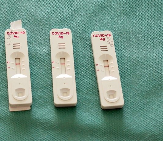 Antigen Test Schweiz