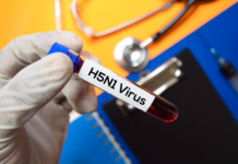 H5N1 Spanien