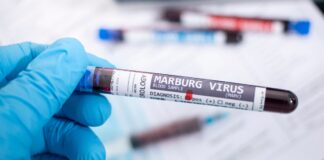 Marburg Virus Spanien