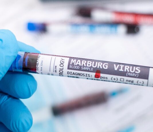 Marburg Virus Spanien