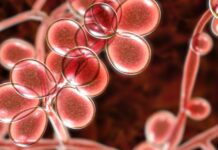 Candida Parapsilose Spanien Alarm