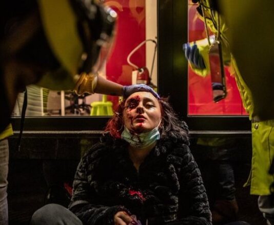 Frau verliert ihr Auge durch eine Polizeischießerei in Barcelona Richter stellt Verfahren gegen 3 Mossos ein