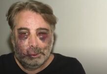 Brutale Prügelattacke auf einen Einwohner von Ferrol weil er einige junge Leute gebeten hatte in den frühen Morgenstunden keinen Lärm zu machen