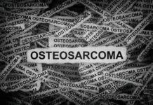 Osteosarkom Forschung Spanien