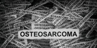 Osteosarkom Forschung Spanien